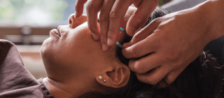 woman getting an acupuncture treatment on face