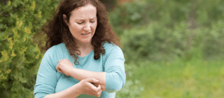 Woman standing outside scratching the skin on her arm