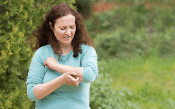 Woman standing outside scratching the skin on her arm